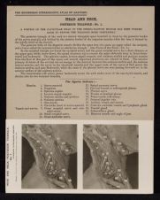 Head and Neck. Posterior Triangle - no. 1