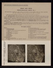 Head and Neck. Pterygo-Maxillary Region - no. 2