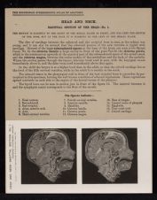 Head and Neck. Sagittal Section of the Head - no. 1