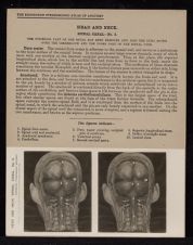 Head and Neck. Spinal Canal - no. 2