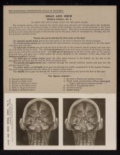 Head and Neck. Spinal Canal - no. 4