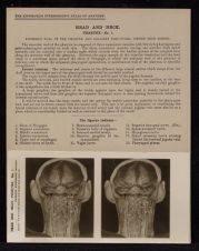 Head and Neck. Pharynx - no. 1