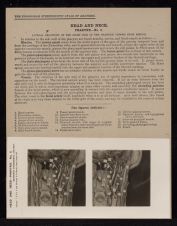 Head and Neck. Pharynx - no. 3