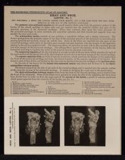 Head and Neck. Larynx - no. 2