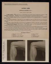 Lower Limb. Surface Anatomy - no. 4