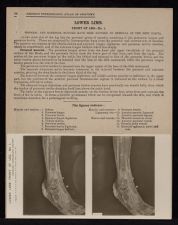 Lower Limb. Front of Leg - no. 1