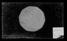 Tonsil tissue sample glass negative